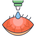 Oculoplasty