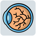 Retina